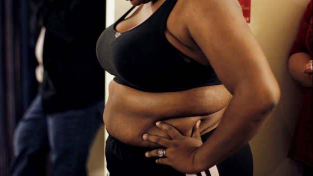More than 20 million Americans have Type 2 diabetes; most are overweight or obese.  (Photo courtesy of Atlanta Black Star)