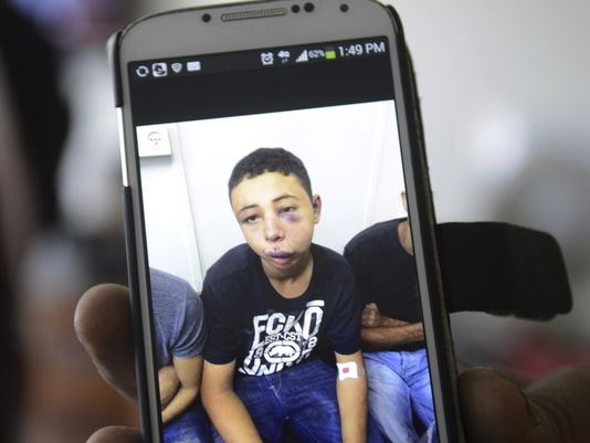 Suha Abu Khdeir, mother of Tariq Abu Khdeir, a U.S. citizen who goes to school in Tampa, shows a mobile phone photo of Tariq taken in a hospital after he was beaten and arrested by the Israeli police. (Mahmoud Illean, AP)