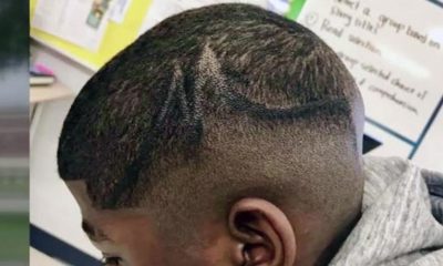 Photo of Juelz Trice’s scalp after Sharpie was used on his head by three White Pearland ISD employees