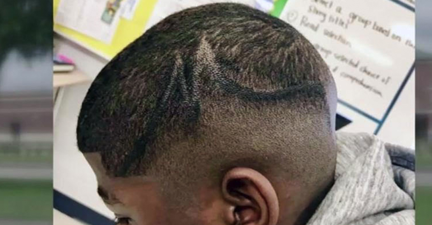 Photo of Juelz Trice’s scalp after Sharpie was used on his head by three White Pearland ISD employees
