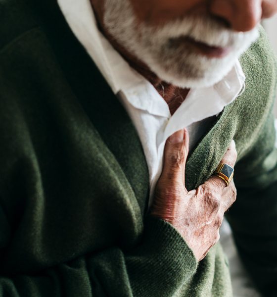 Age-related ATTR-CM primarily affects white men, but the genetic version almost exclusively targets Black people. In extreme cases, a patient may require a heart transplant and a liver transplant since the protein is produced in the liver.