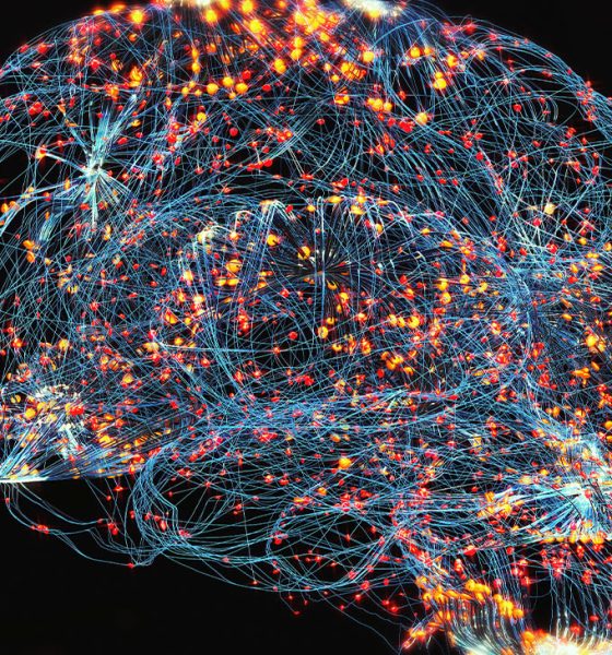 Brain activity, Human brain damage, Neural network, Artificial intelligence and idea concept